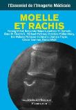 Imagerie de la moelle et du rachis