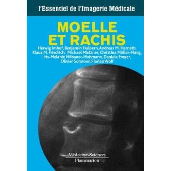 Imagerie de la moelle et du rachis