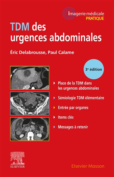 TDM des urgences abdominales - Eric Delabrousse - broché