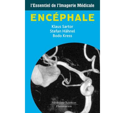 Imagerie de l'encephale