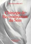 Chirurgie de reconstruction du sein