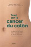 Tout sur le cancer du côlon