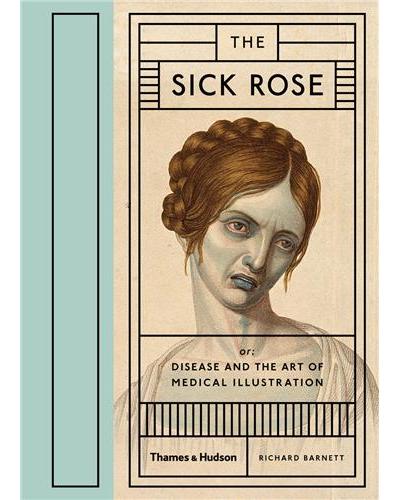 SICK ROSE DISEASE AND THE ART OF MEDICAL ILLUSTRATION