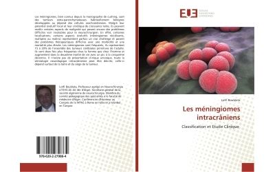 Les méningiomes intracrâniens