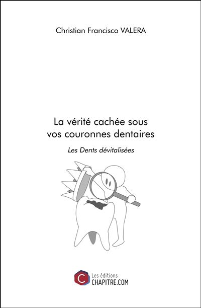 La vérité cachée sous vos couronnes dentaires