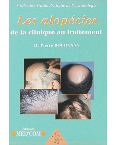 Les alopécies