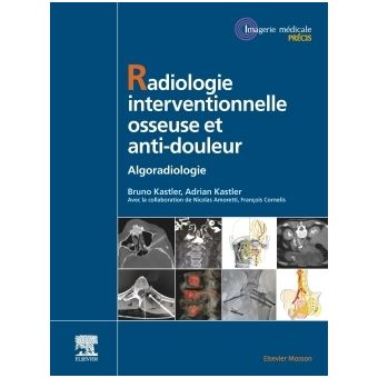 Radiologie Interventionnelle osseuse et anti-douleur