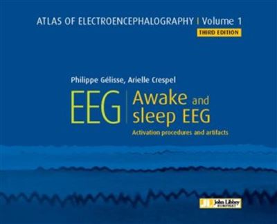 EEG awake and sleep EEG activation procedures and artefacts