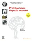 Prothèse totale d'épaule inversée