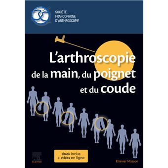 L'arthroscopie de la main, du poignet et du coude
