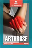 C'est quoi Docteur : l'arthrose