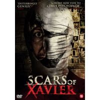 Scars of xavier-NL