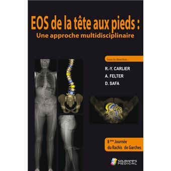 Eos de la tete aux pieds : une approche multidisciplinaire