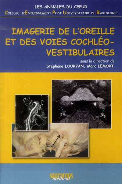Imagerie de l'oreille et des voies cochleo-vestibulaires - annales du ...