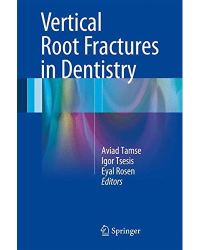 Vertical root fractures in dentistry