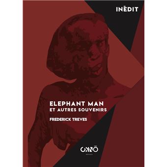 Elephant Man