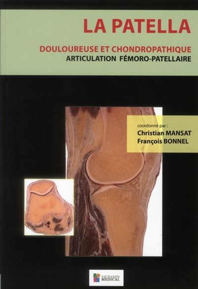 La patella douloureuse et chondropathique