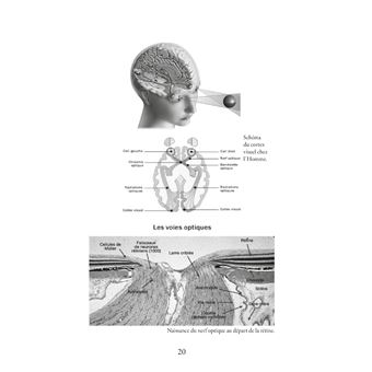 Soignez vos yeux naturellement
