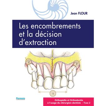 Les encombrements et la décision d'extraction