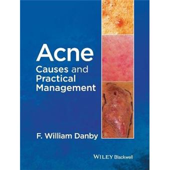 Acne - Causes and Practical Management - Hardback - 2015 - 1