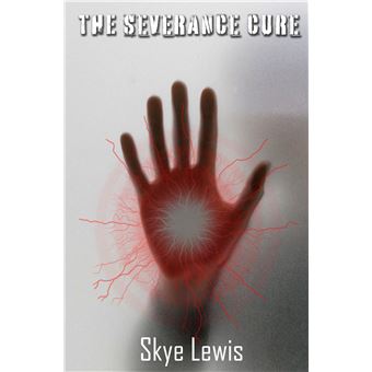 The Severance Cure - The Dome Code 3 - 1