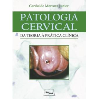 Patologia Cervical. Da Teoria à Prática - 1