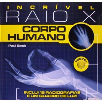 Incrível Raio X. Corpo Humano (+ 16 Radiografias + Quadro De Luz) - 1