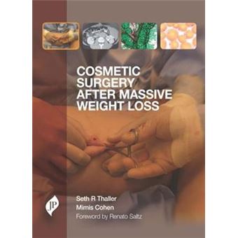 Cosmetic Surgery After Massive Weight Loss - 1