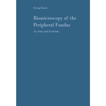 Biomicroscopy of the Peripheral Fundus - An Atlas and Textbook - Paperback - 2012 - 1