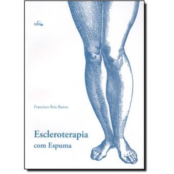 Escleroterapia Com Espuma - 1