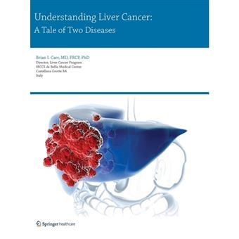 Understanding Liver Cancer - A Tale of Two Diseases - Paperback - 2014 - 1