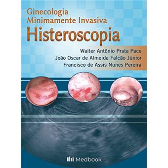 Histeroscopia - Ginecologia Minimamente Invasiva - 1