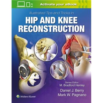 Illustrated Tips And Tricks In Hip And Knee Reconstructive And Replacement Surgery By Lippincott Williams And Wilkins - 1