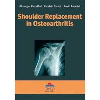 Shoulder Replacement In Osteoarthritis - [Version Originale] - 1