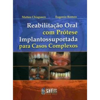 Reabilitação Oral com Prótese Implantossuportada Para Casos Complexos - 1