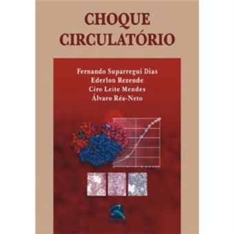 Choque Circulatorio Alvaro Rea Neto Outros Livros Alvaro Rea
