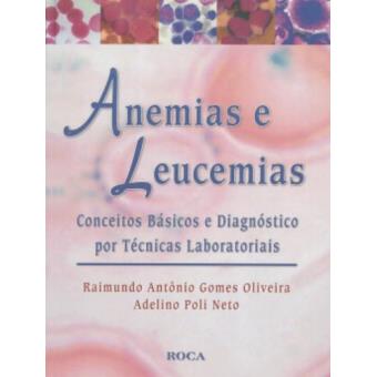 Anemias E Leucemias Conceitos Basicos E Diagnostico Por Tecnicas Laboratoriais - 1
