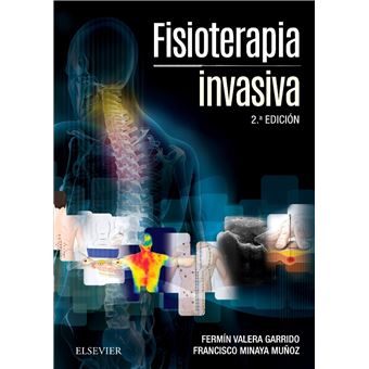 Fisioterapia Invasiva - 1