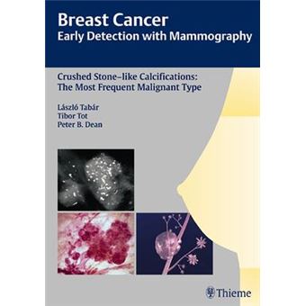 Breast Cancer: Early Detection with Mammography : Crushed Stone-like Calcifications: The Most Frequent Malignant Type - 1