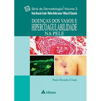 Doenças Dos Vasos E Hipercoagulabilidade Na Pele - 1