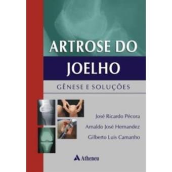 Artrose Do Joelho. Gênese E Soluções - 1