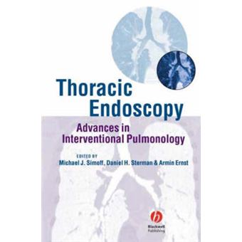 Thoracic Endoscopy - Advances in Interventional Pulmonology - Hardback - 2006 - 1