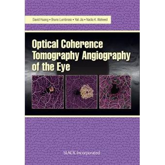 Optical Coherence Tomography Angiography of the Eye - 1