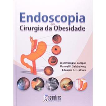 Endoscopia em Cirurgia da Obesidade - 1
