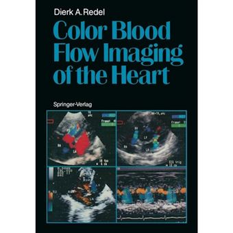 Color Blood Flow Imaging of the Heart - Paperback - 2011 - 1