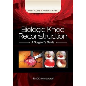 Biologic Knee Reconstruction - 1