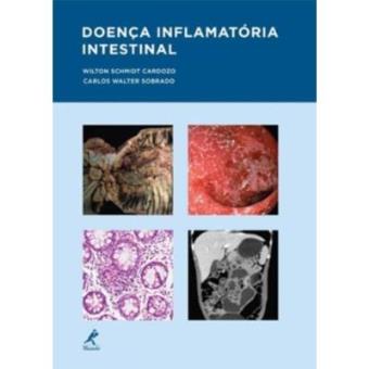 Doença Inflamatória Intestinal - 1