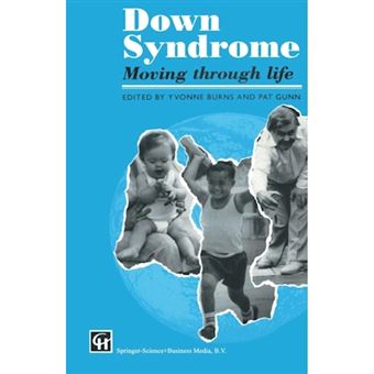 Down Syndrome: Moving Through Life - Paperback - 1993 - 1