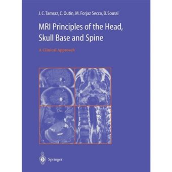 MRI Principles of the Head, Skull Base and Spine - A Clinical Approach - Paperback - 2013 - 1