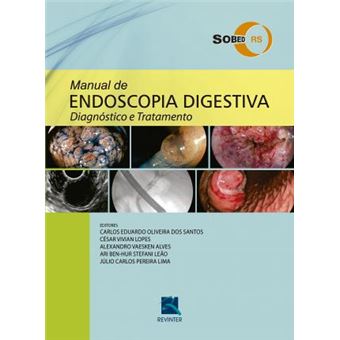 Manual de Endoscopia Digestiva. Diagnóstico e Tratamento - 1